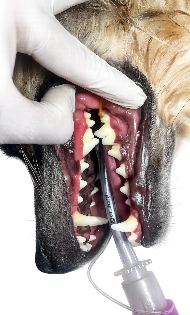 Limpieza Dental Profesional