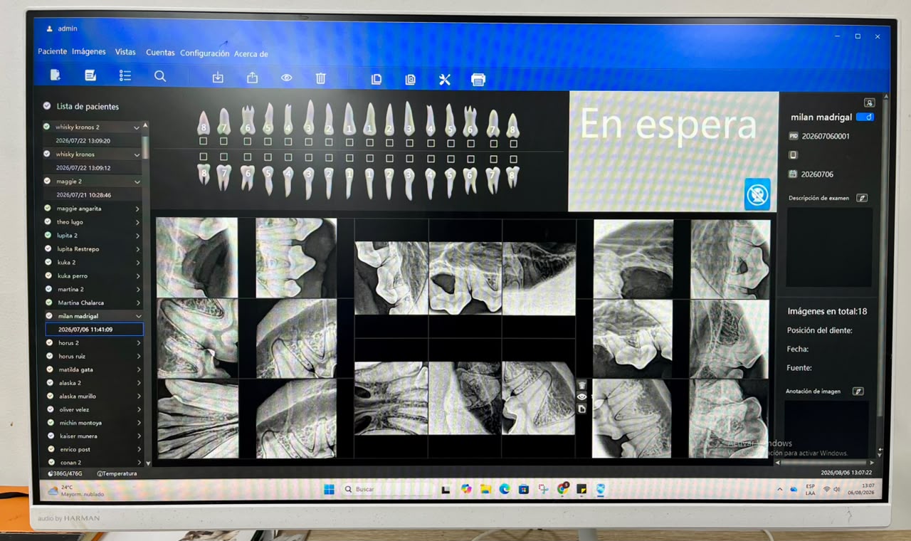 Radiografía dental digital