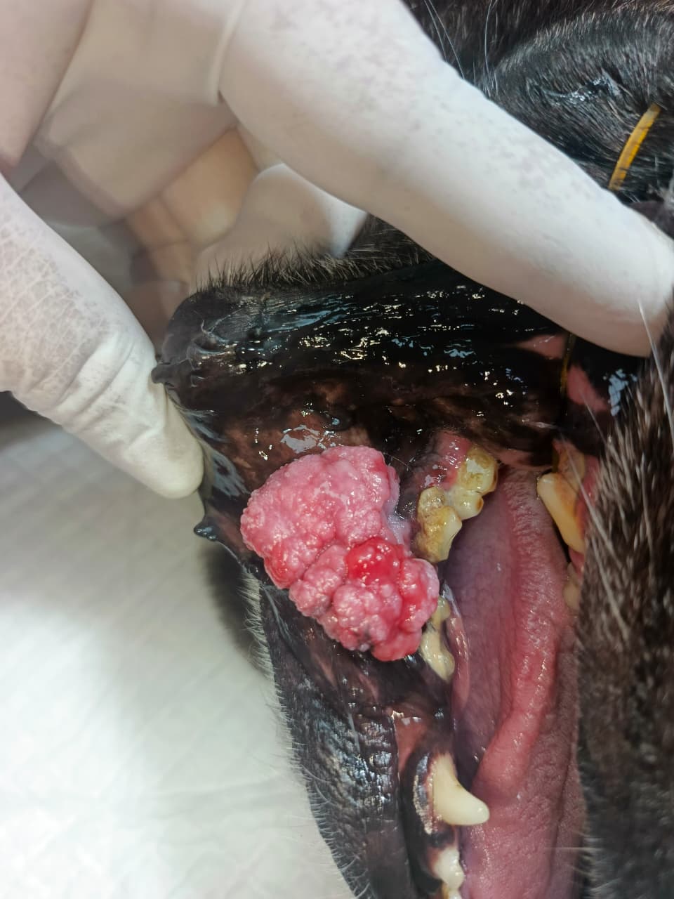 Masa oral en la mucosa mandibular derecha de Martina antes de la cirugía